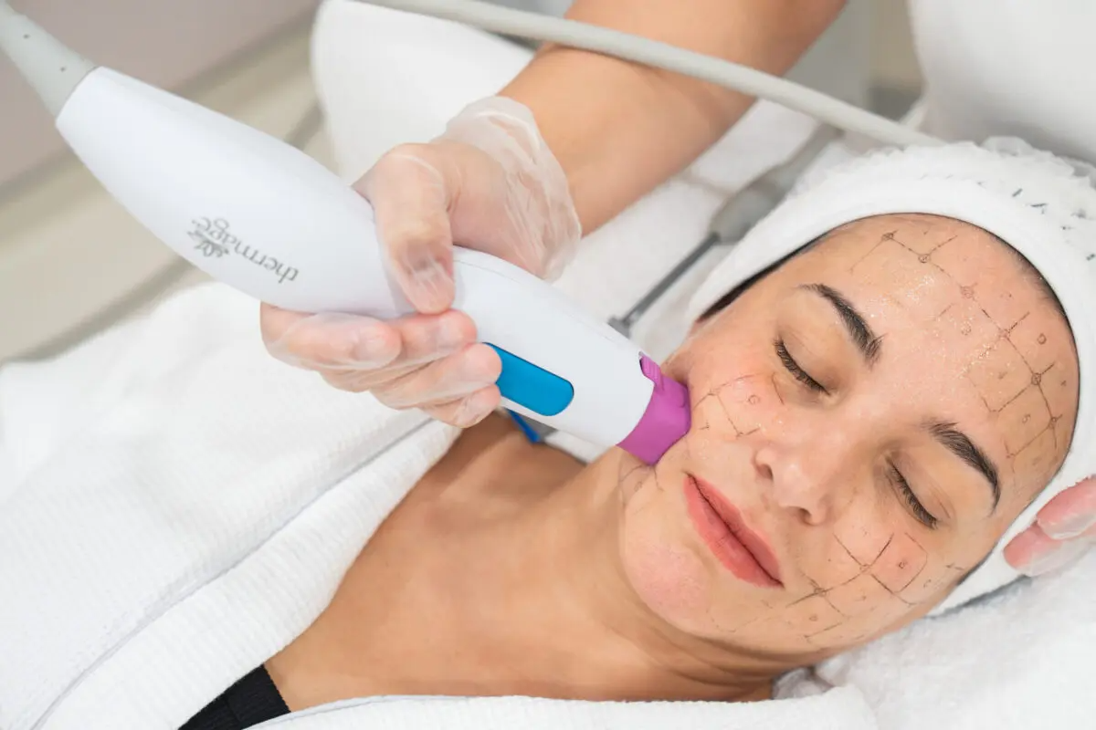 韓國 玩美電波 完美電波 oligio X 超玩美電波 醫美推薦拉提 小鳳凰電波 平替版 電波