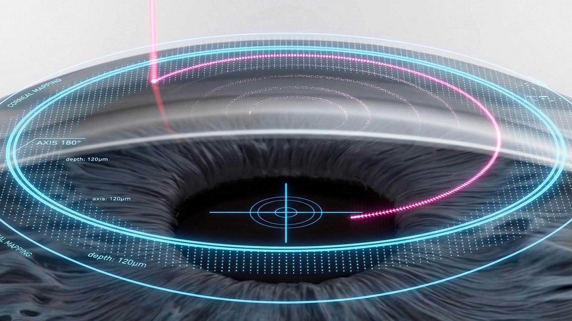 江南好眼睛眼科 金俊憲院長專欄 — 視力矯正的「絲綢」美學：SILK 絲綢雷射全攻略