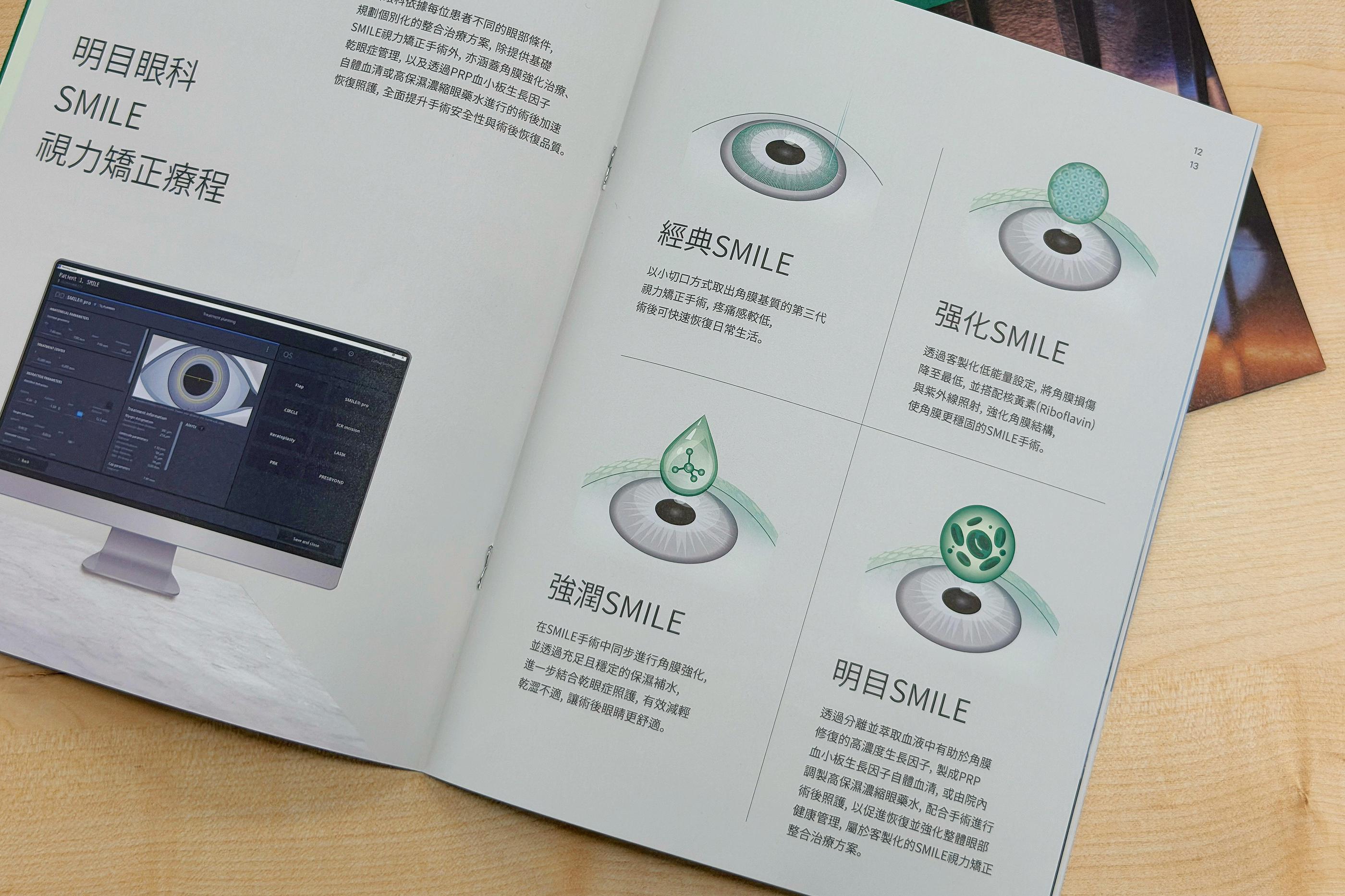 SMILE全飛秒矯正療程