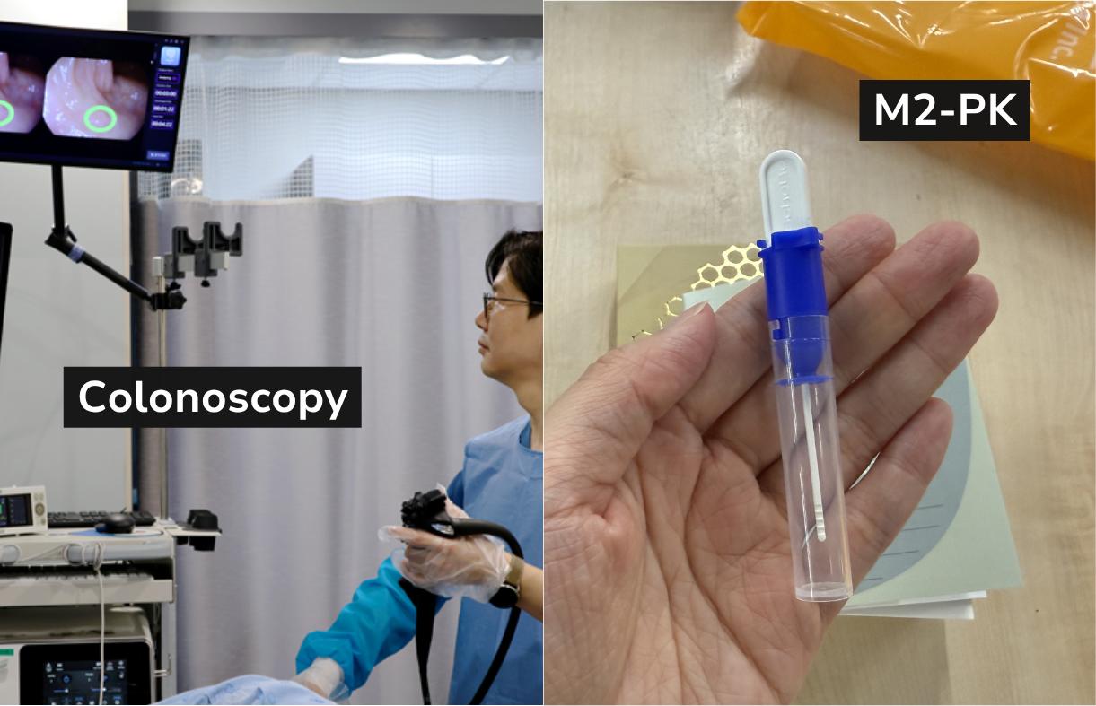 KMI health checkup endoscopy guide image 9