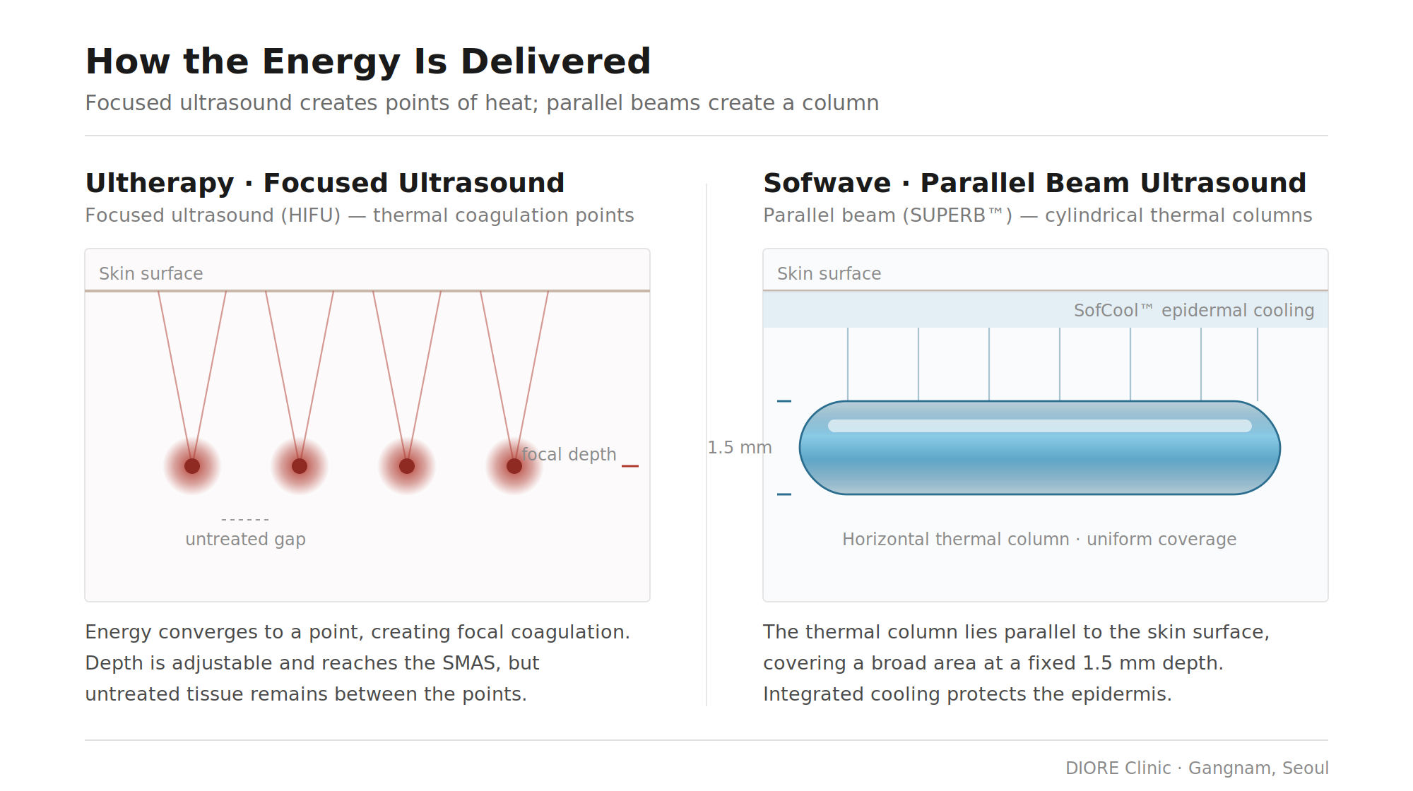 Difference in energy delivery between focused ultrasound and parallel beams