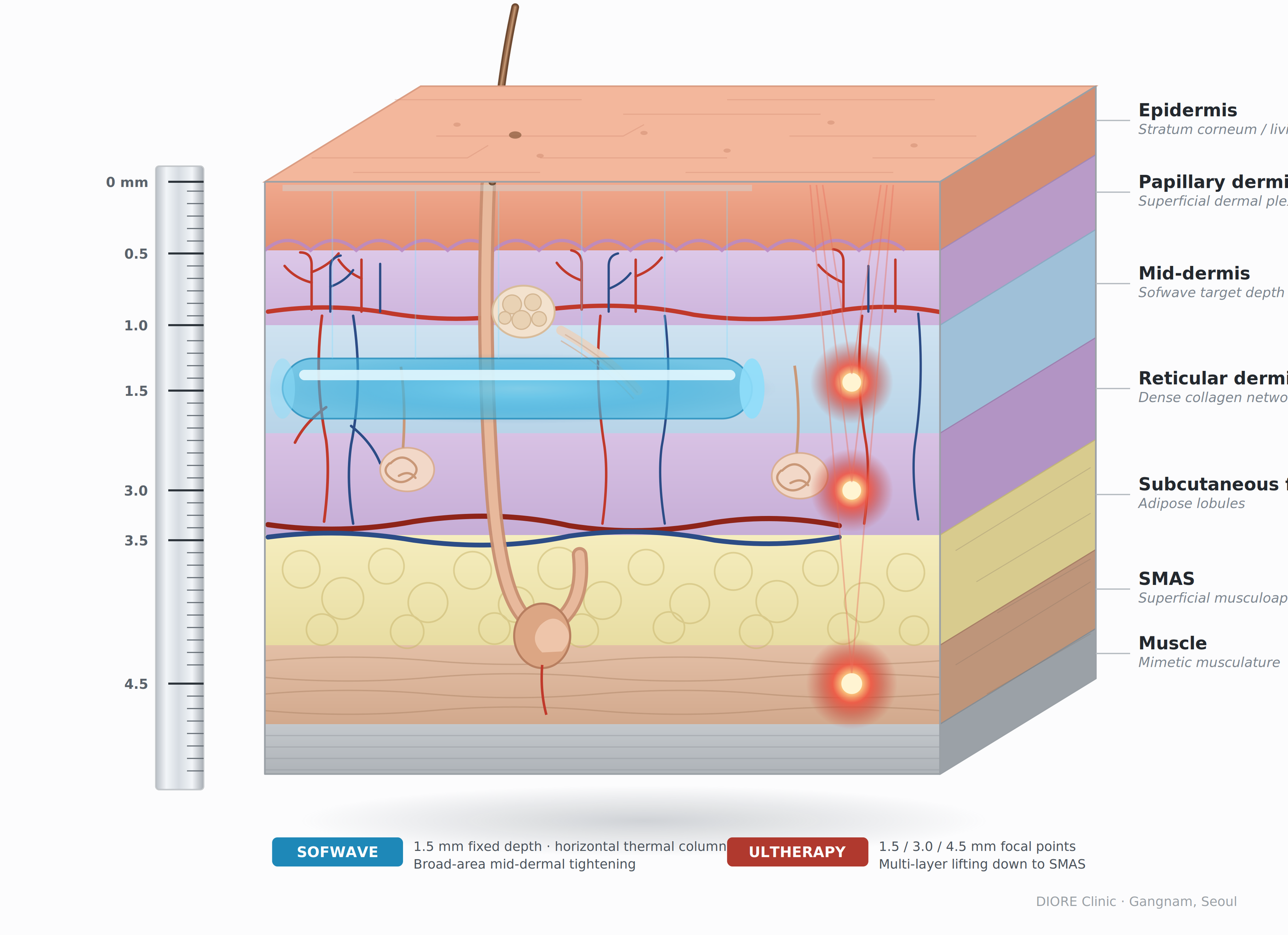 Skin cross-section structure and energy penetration depth by treatment