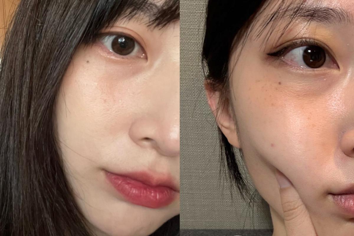 Illustration showing common signs of dry, less firm-looking skin, including visible smile lines and uneven makeup