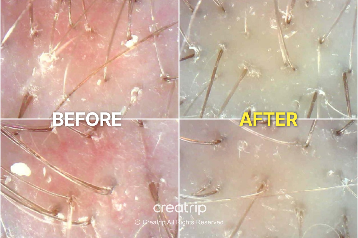 Before-and-after scalp imaging from the same head spa session