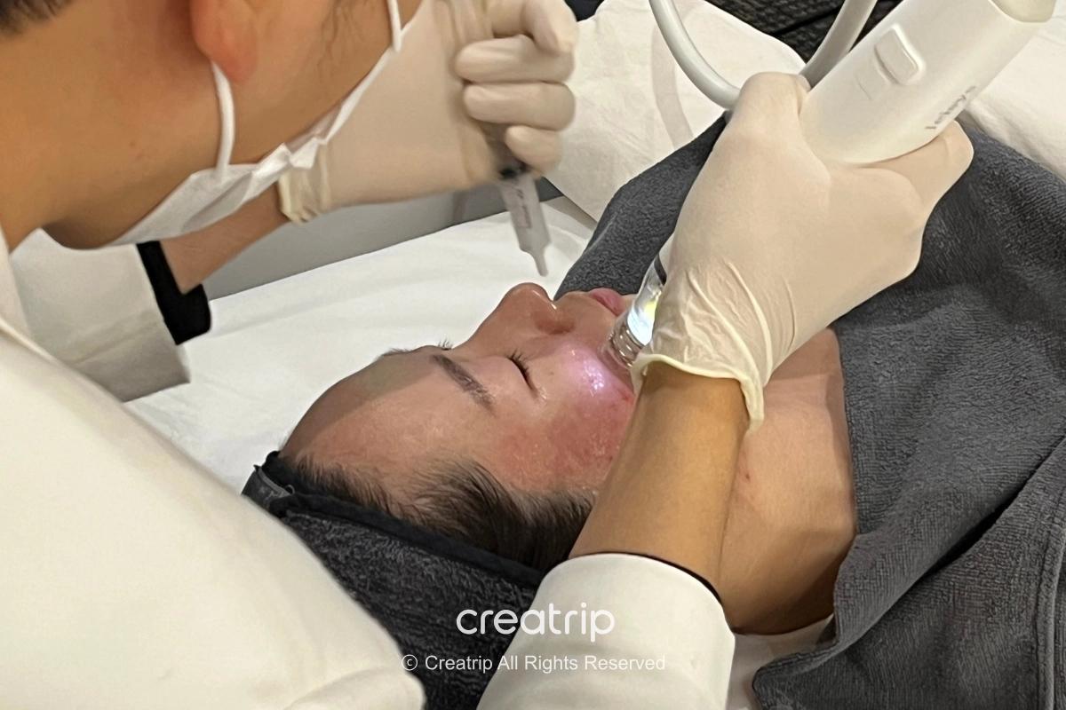 美容クリニックで顔の施術を受ける様子