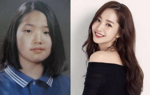 Comparison of before and after photos showing effective cosmetic surgery transformations discussed openly by Korean celebrities like Park Min-young.