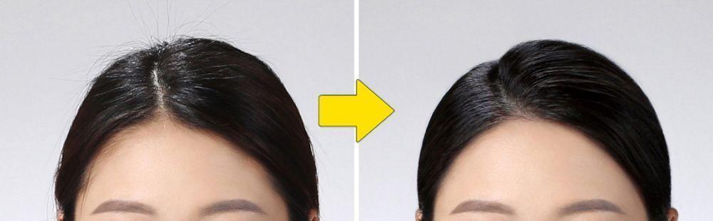 在韓國弘大Time On Me Studio進行的修圖前後對比，一位女士的額頭和髮型在修圖前後的變化，使得她在證件照中顯得更整潔和有型。