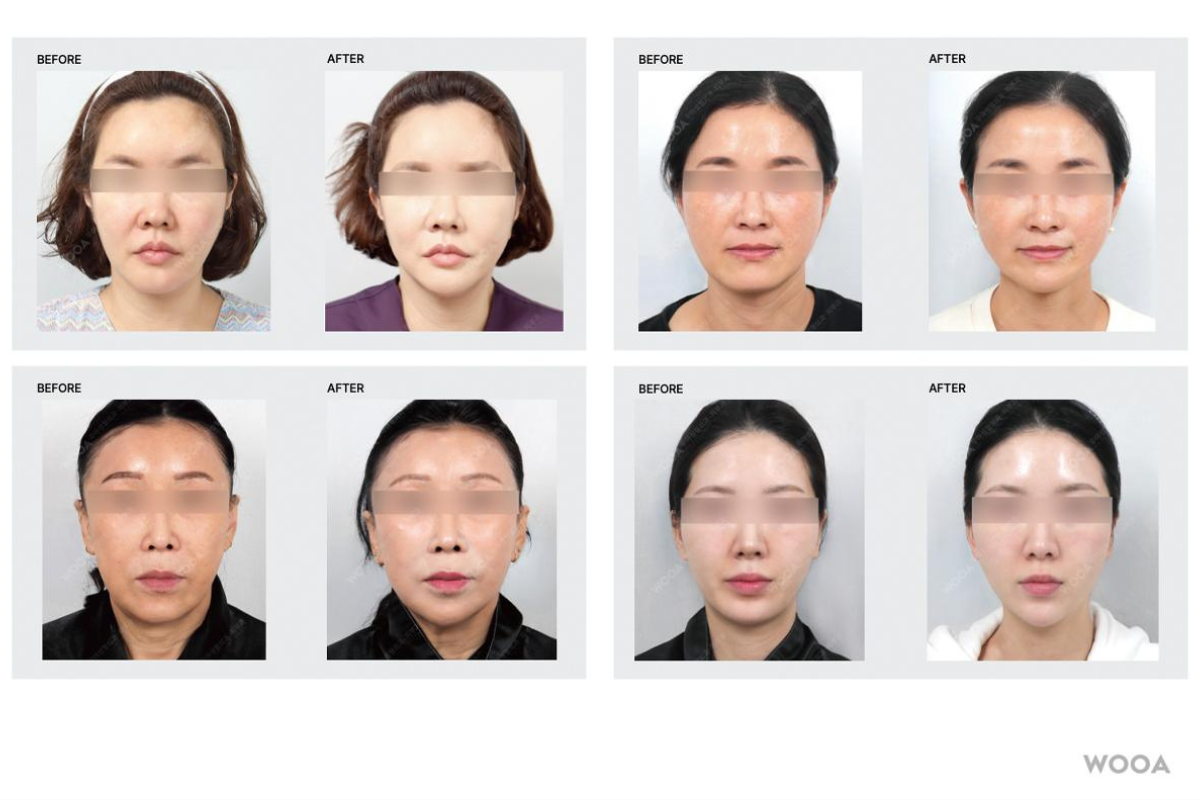 新沙醫美診所推薦 清潭洞醫美診所推薦 狎鷗亭醫美診所推薦 新沙醫美 清潭醫美 狎鷗亭醫美 微整形 江南醫美診所價錢比較 韓國醫美資訊 Creatrip預約