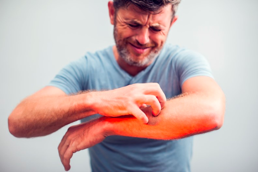 韓國藥局 發癢 韓文 간지럽다 藥店購買止癢藥描述