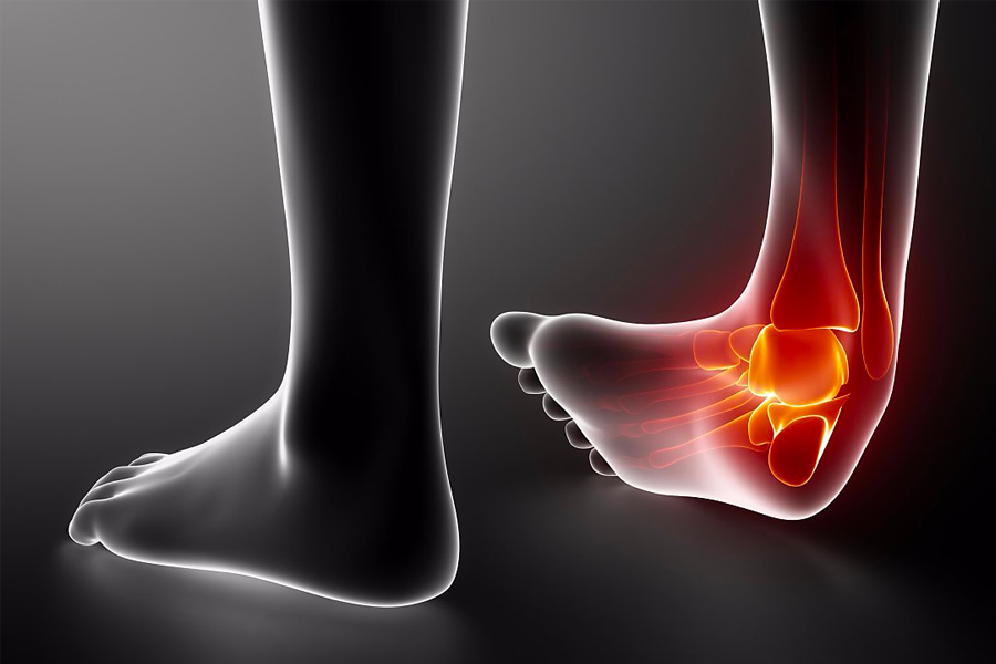 韓國藥局 扭到 韓文 삐다 藥店購買治療扭傷藥描述