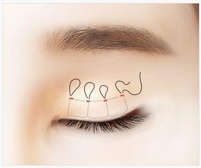 Apgujeong WOOA Plastic Surgery Clinic