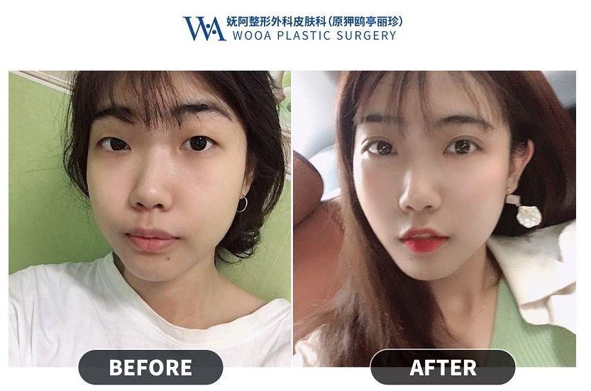 Apgujeong WOOA Plastic Surgery Clinic