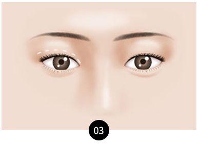 Apgujeong WOOA Plastic Surgery Clinic