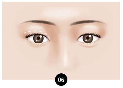 Apgujeong WOOA Plastic Surgery Clinic