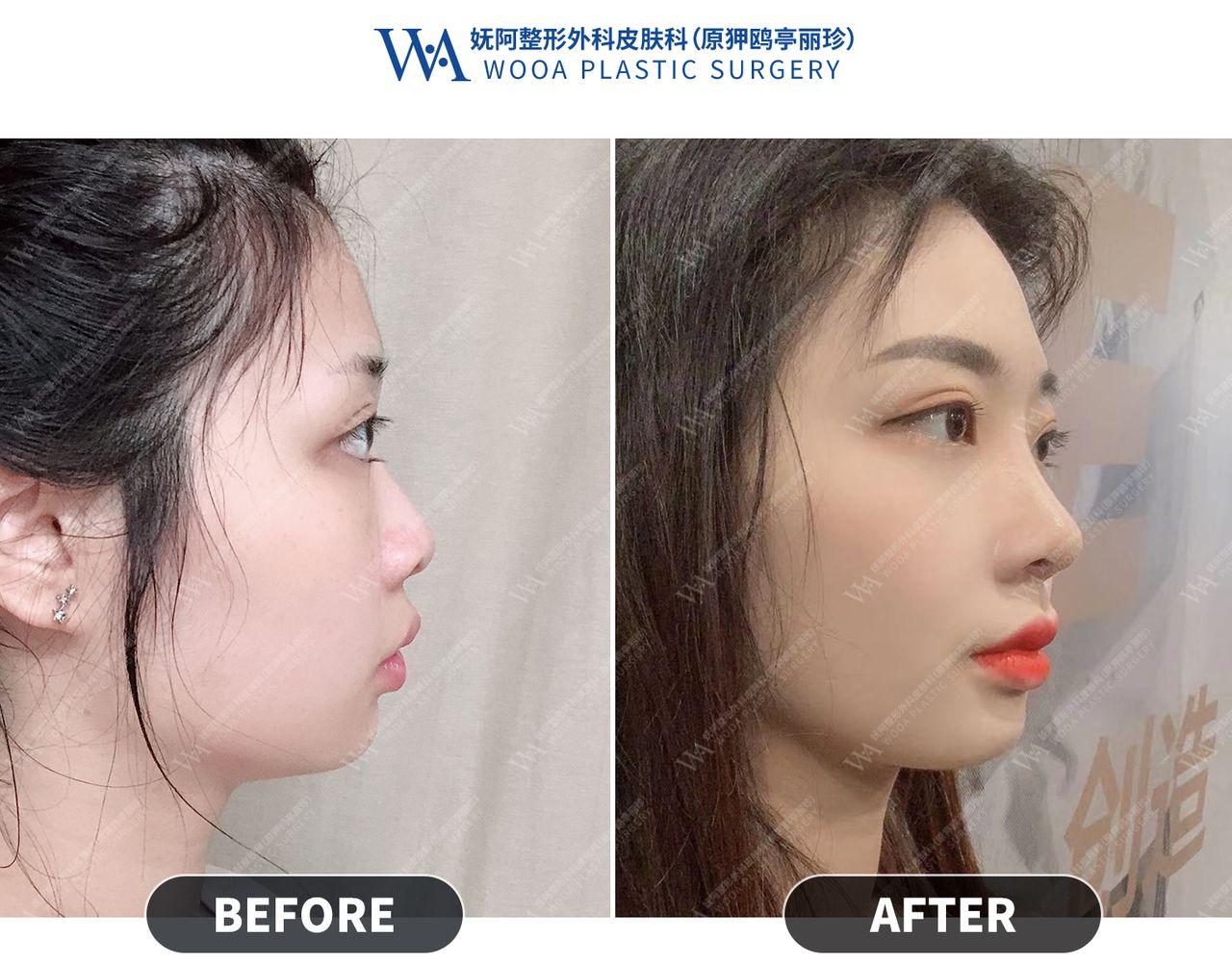 Apgujeong WOOA Plastic Surgery Clinic