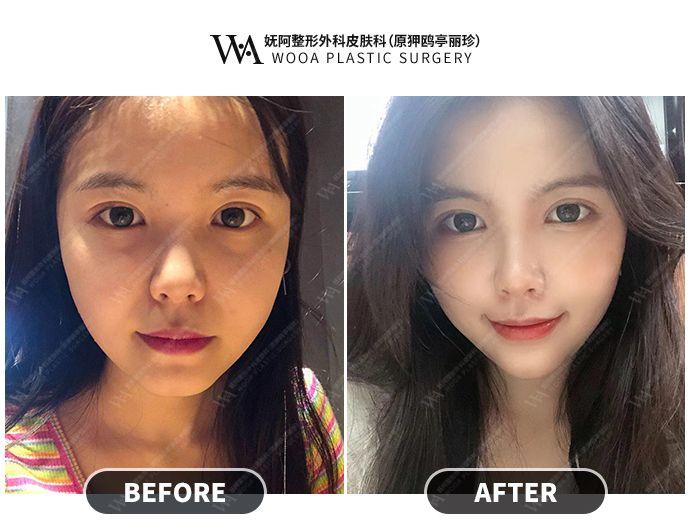 Apgujeong WOOA Plastic Surgery Clinic