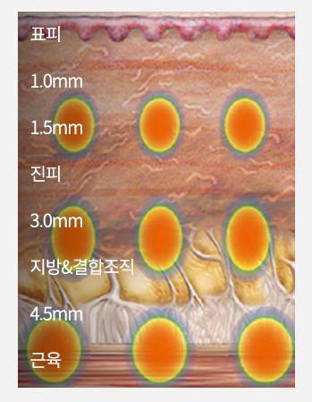Apgujeong WOOA Plastic Surgery Clinic