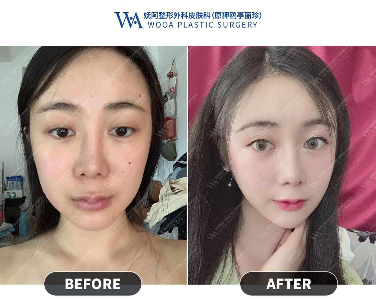 Apgujeong WOOA Plastic Surgery Clinic
