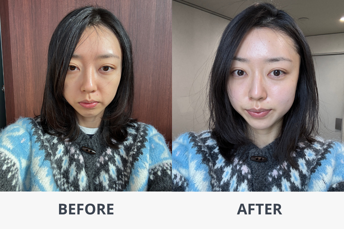 TheiA Clinic AI diagnosis treatment experience Gangnam medical aesthetics Gangnam medical aesthetics clinic introduction Gangnam dermatology