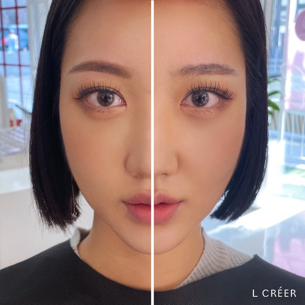 Lcreer髮際線設計諮詢服務展示