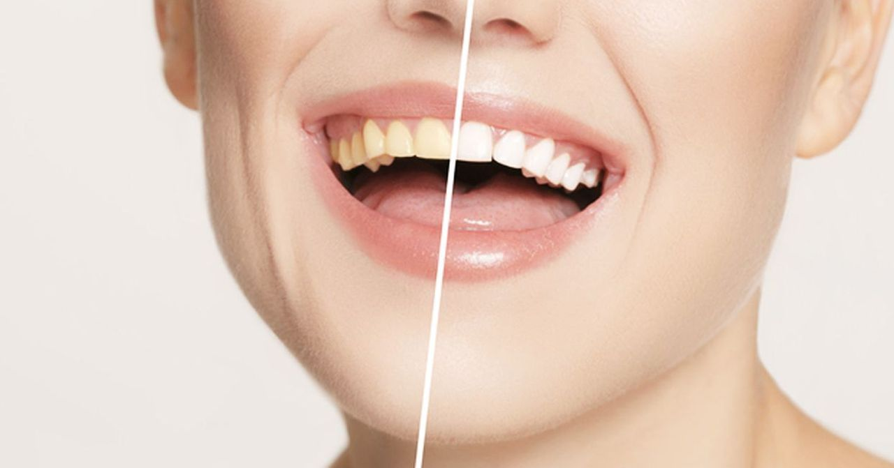 展示牙齒健康的重要性，強調牙齒護理和美白在日常生活中的作用。