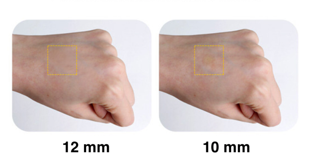 Olive Young Care Plus แพทช์ปกปิดสิวที่สามารถแต่งหน้าทับได้อย่างเนียนสนิท