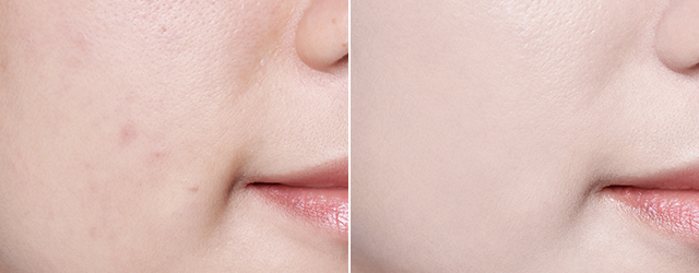 韓国コスメ　韓国ビューティー　韓国クッションファンデ　ラネージュ　Laneige 　ネオクッション　夏のファンデーション　韓国情報