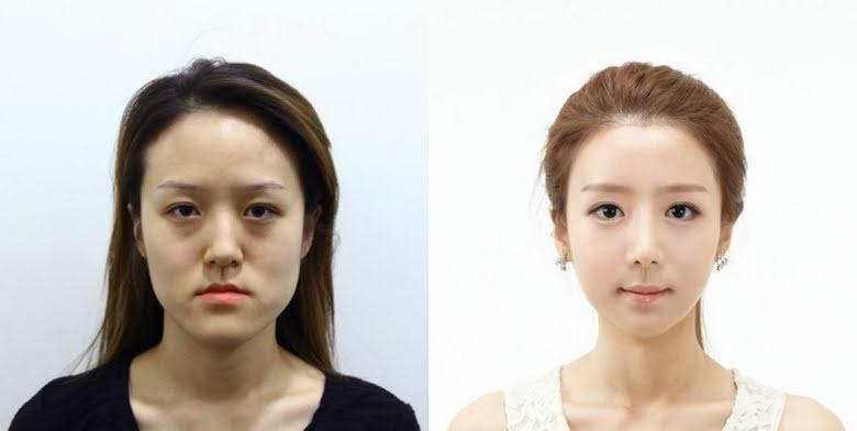 ภาพที่สื่อถึงการศัลยกรรมและความเข้าใจผิดเกี่ยวกับค่านิยมการศัลยกรรมในสังคมเกาหลี
