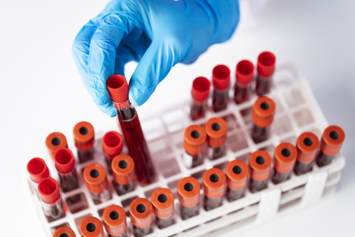 實驗室中的血液樣本，代表韓國夢境中的財富象徵。