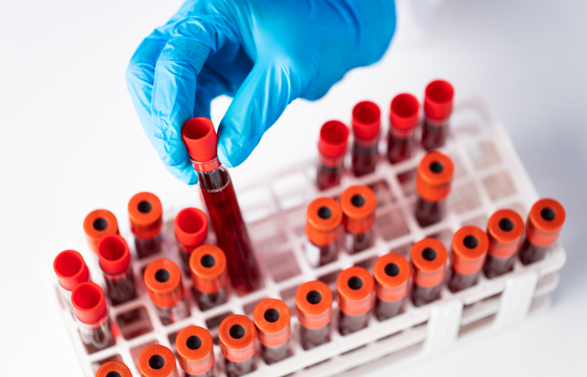 医療用の血液サンプル、韓国での夢佔いで血に関する夢の象徴的なイメージ