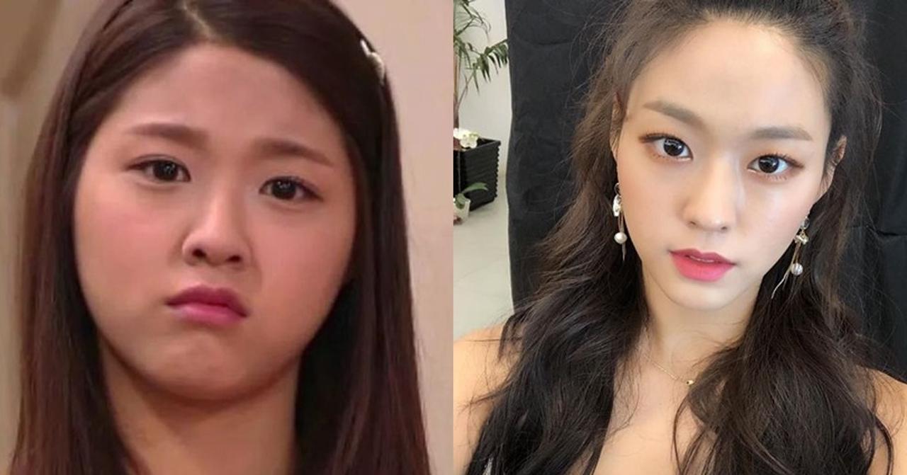 ลดความอ้วนด้วยกาควบคุมแคลอรี่