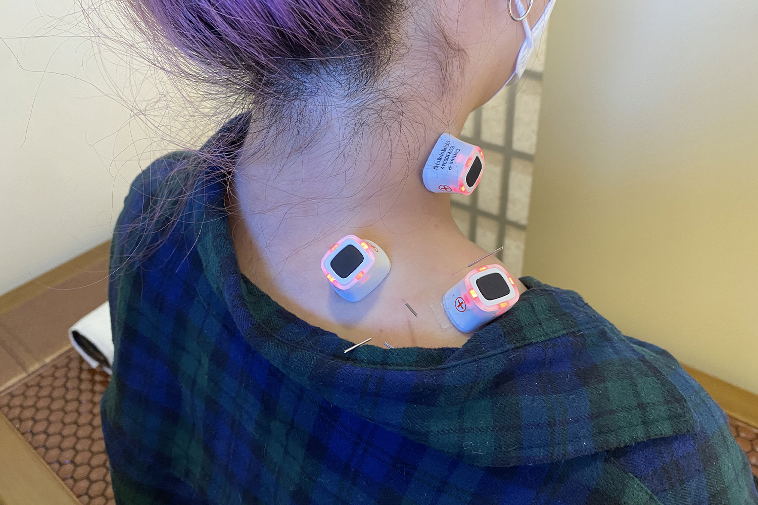 体验针灸的顾客,展示健康检测的现代设备。