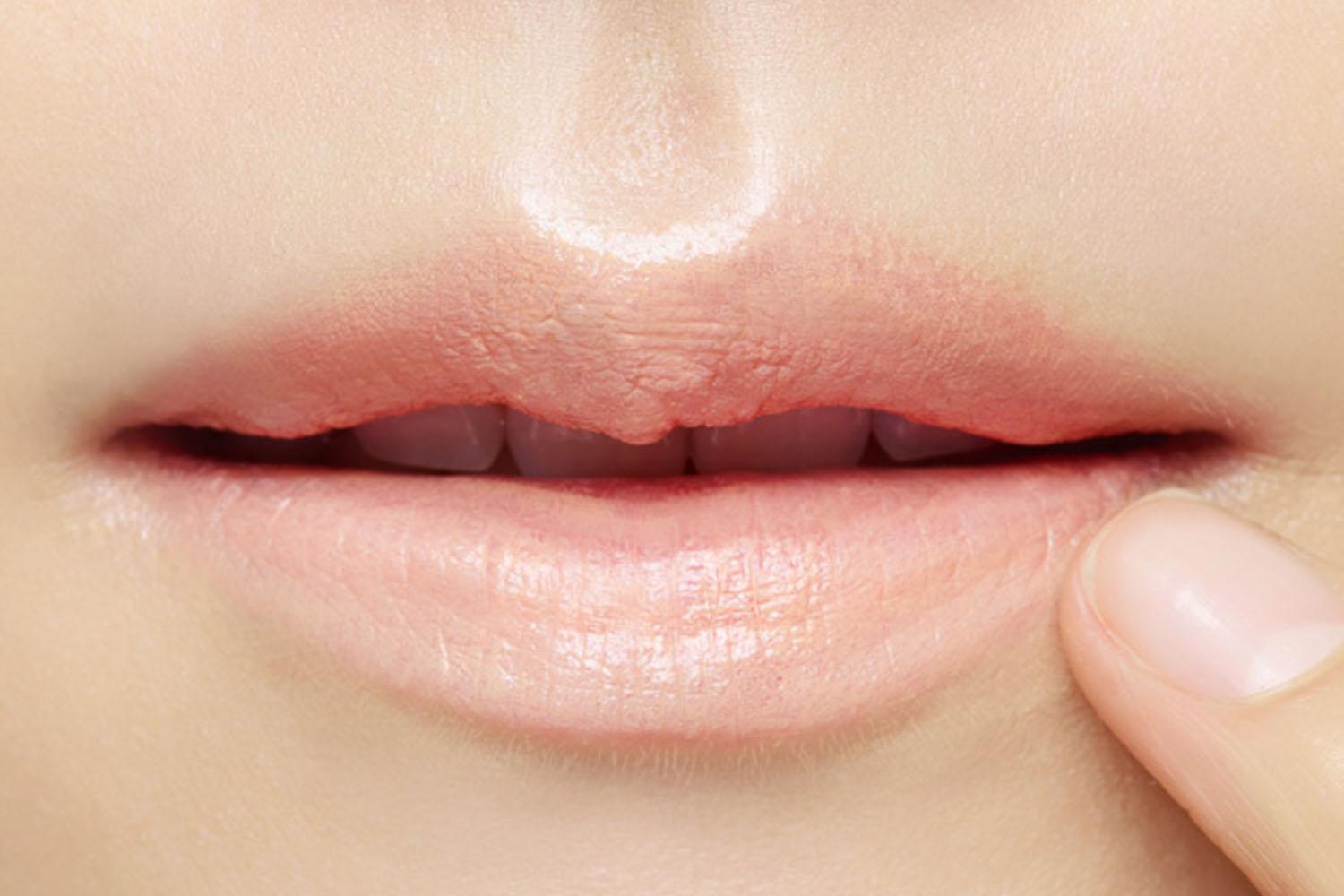 Thoa kem nền lên mô