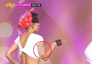 韓國音樂節目中,演出者的手臂上貼有遮擋膠布,以符合韓國電視廣播的審核標準。