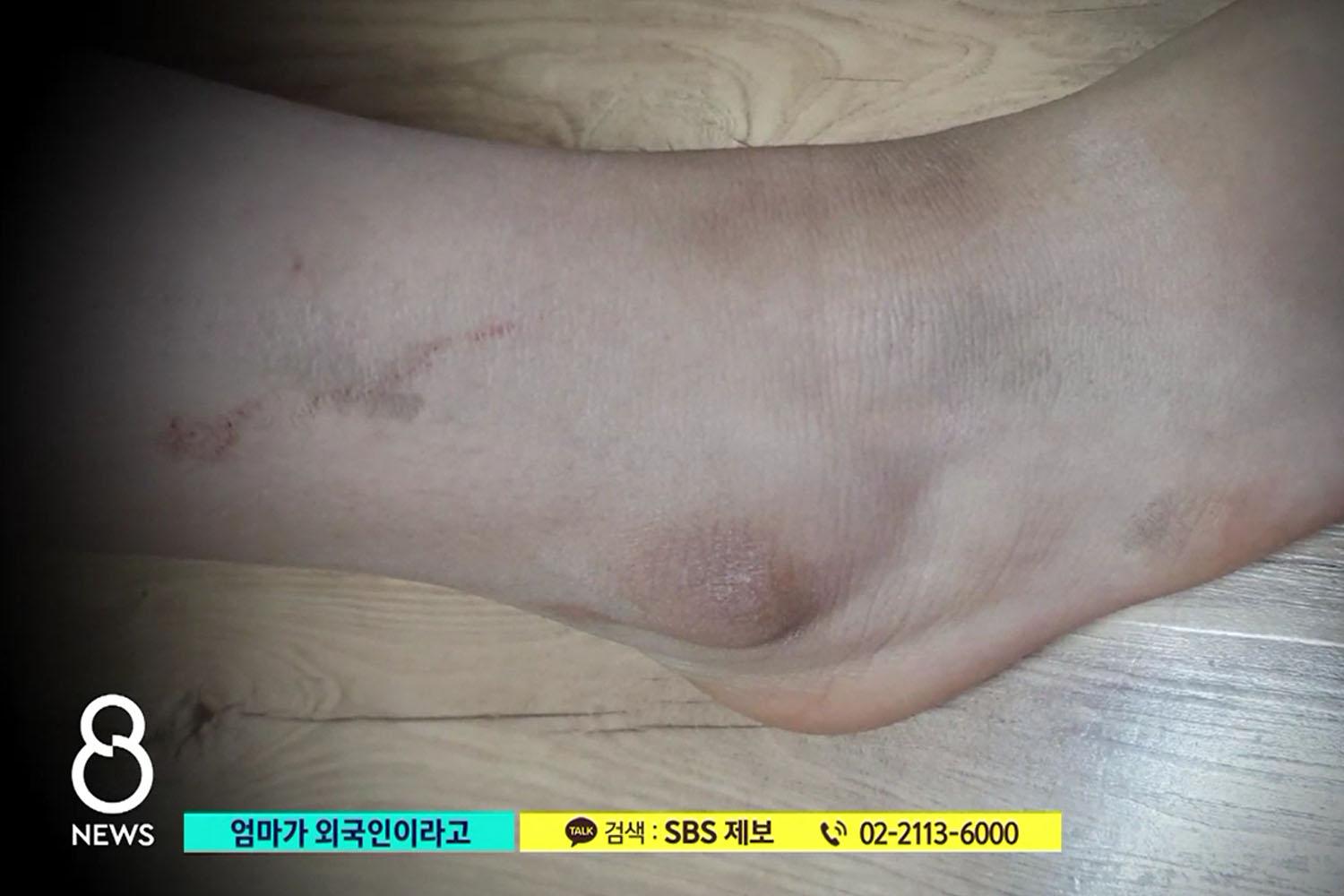 ภาพแสดงเด็กหญิงอายุ 15 ปีขณะเล่าเรื่องการถูกทำร้ายร่างกายจากกลุ่มรุ่นพี่ผู้หญิงที่ดาดฟ้าของอาคารในเมืองอัลซาน ประเทศเกาหลี เนื่องจากเธอมาจากครอบครัวผู้ปกครองชาวต่างชาติ.