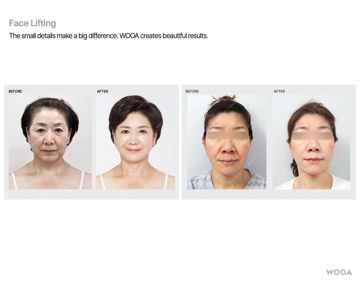 Wooa clinic