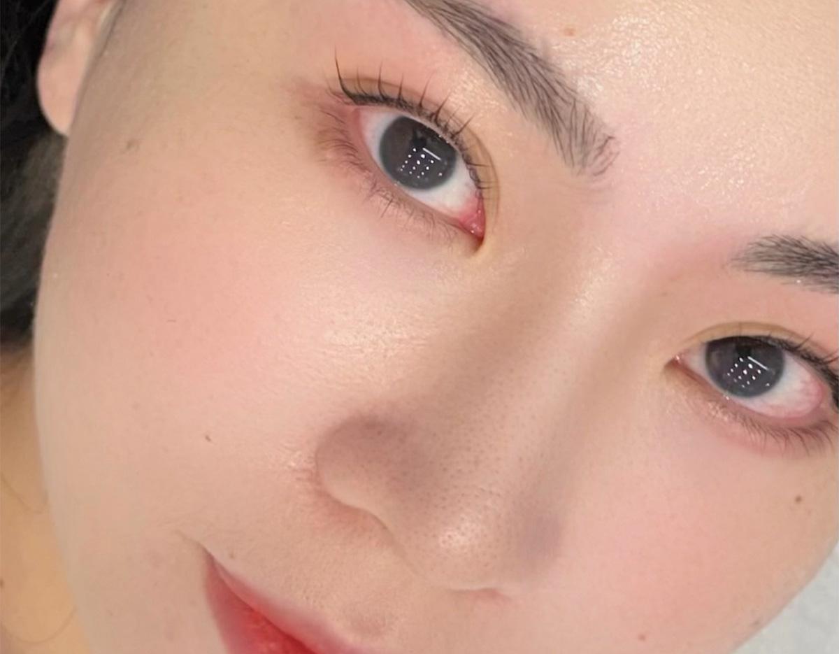 eyeholic