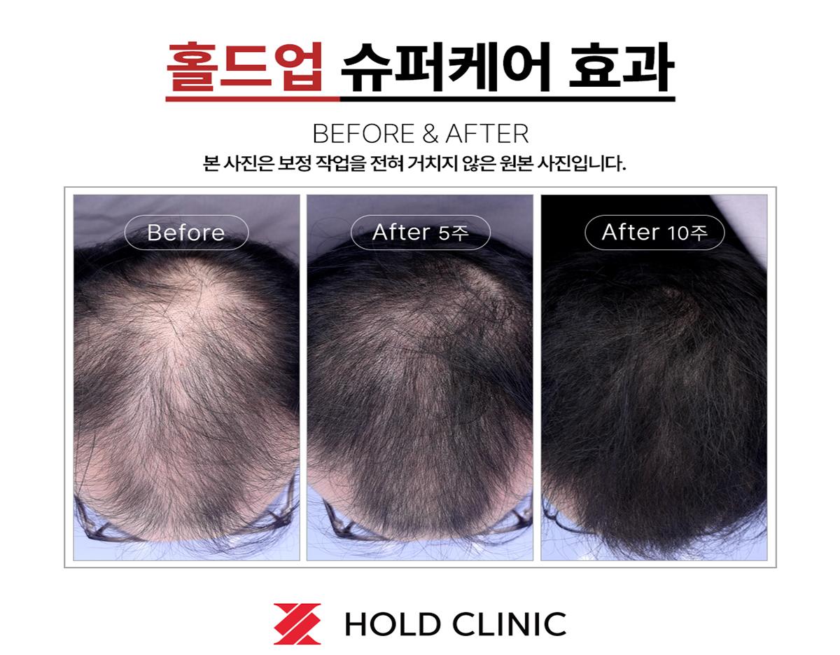 Hold Clinic