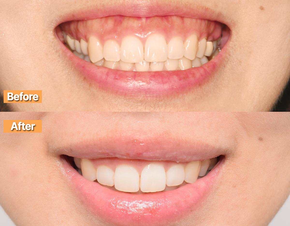 Yonsei Good Day Dental Clinic | Gangnam Branch-image