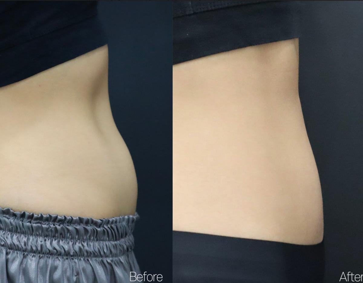 Lamine Skin Clinic