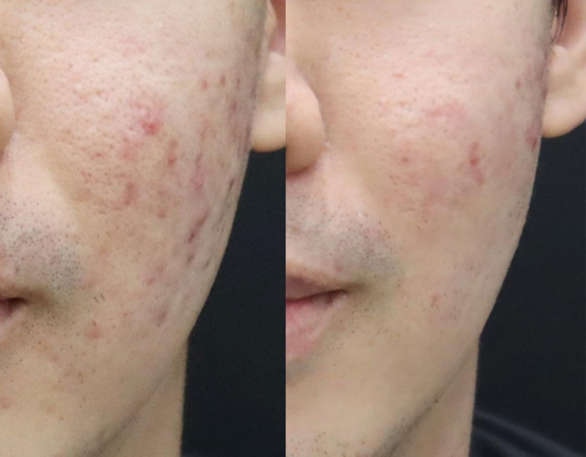 Lamine Skin Clinic