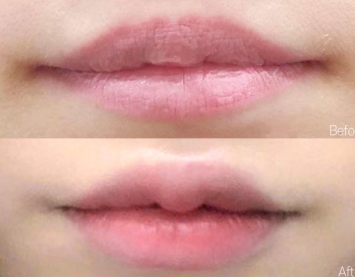 Lamine Skin Clinic