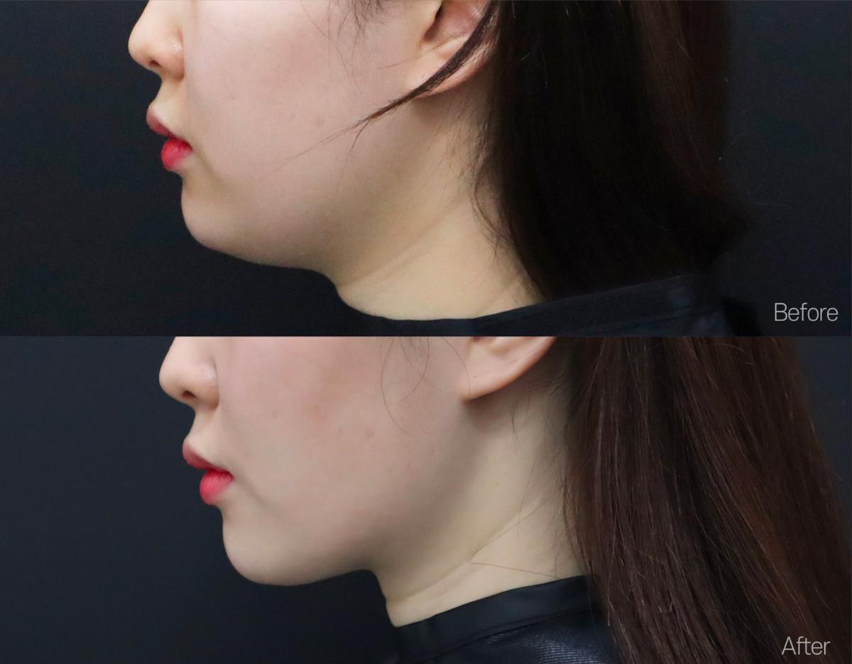 Lamine Skin Clinic