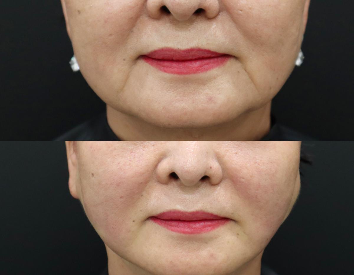 Lamine Skin Clinic