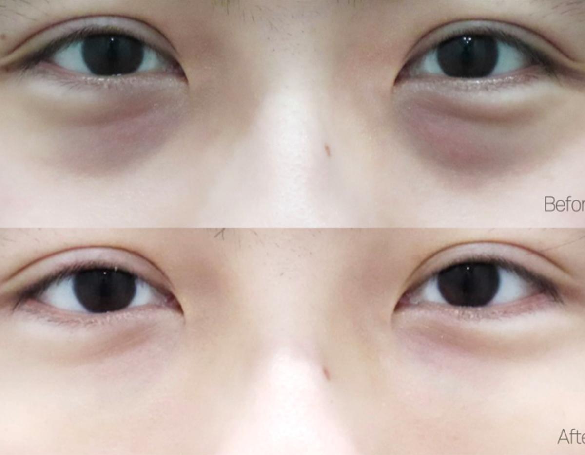 Lamine Skin Clinic