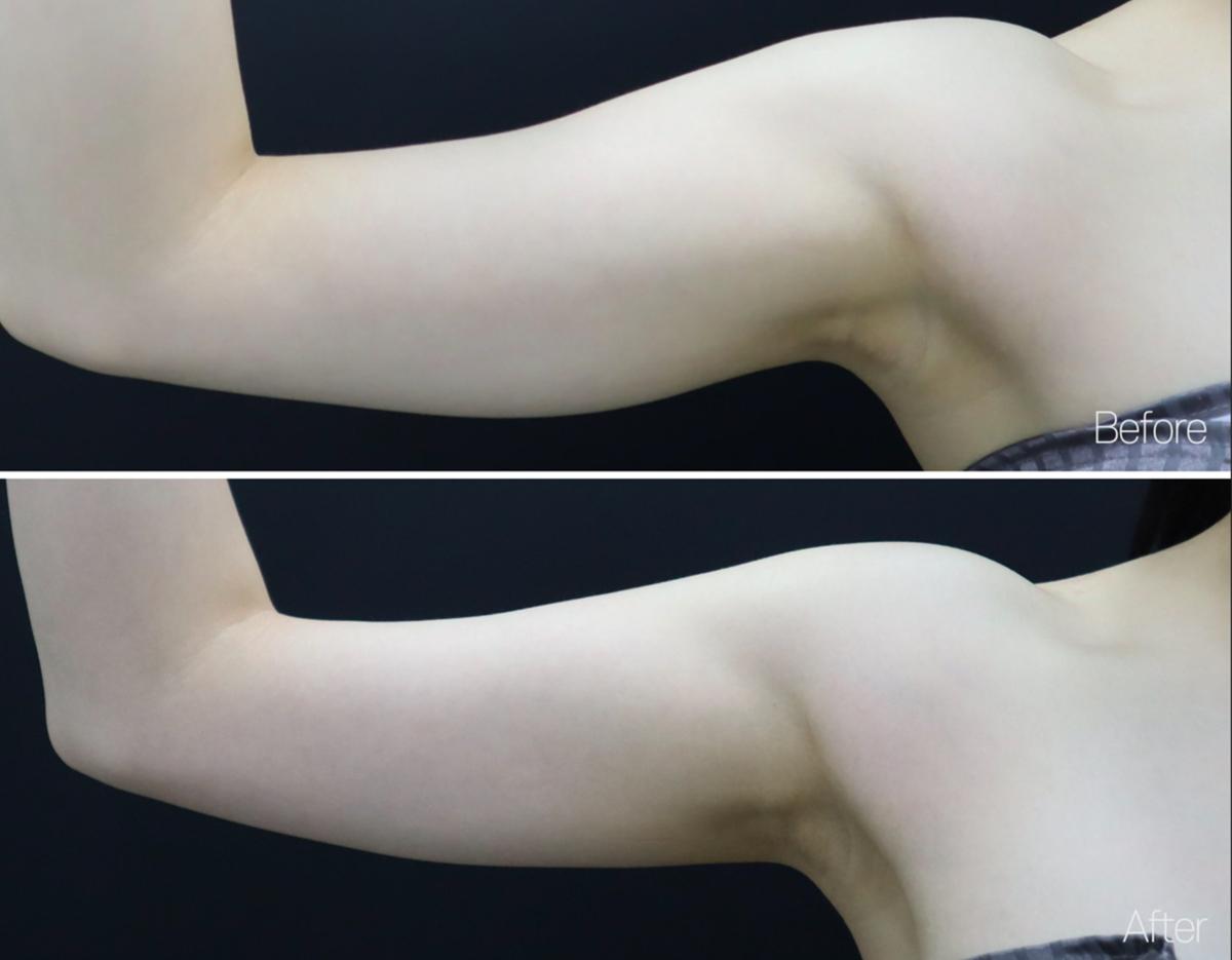 Lamine Skin Clinic
