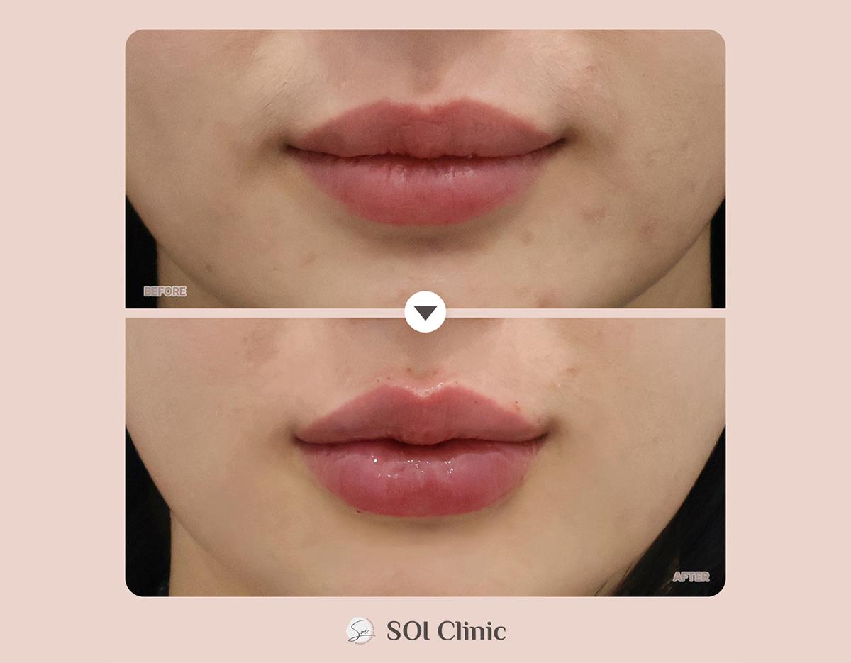 soi clinic