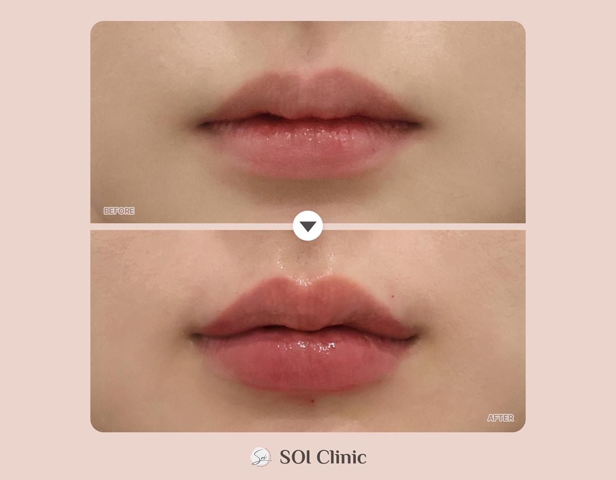 soi clinic