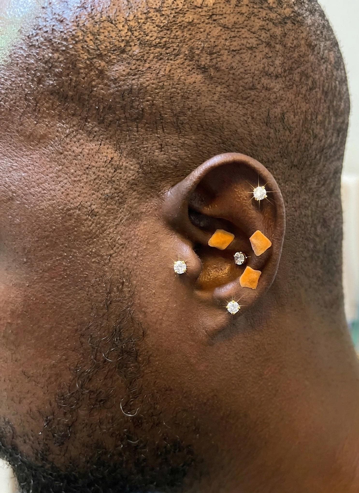 Weight Management I Myeongdong Siwon Korean Medicine Clinic 3