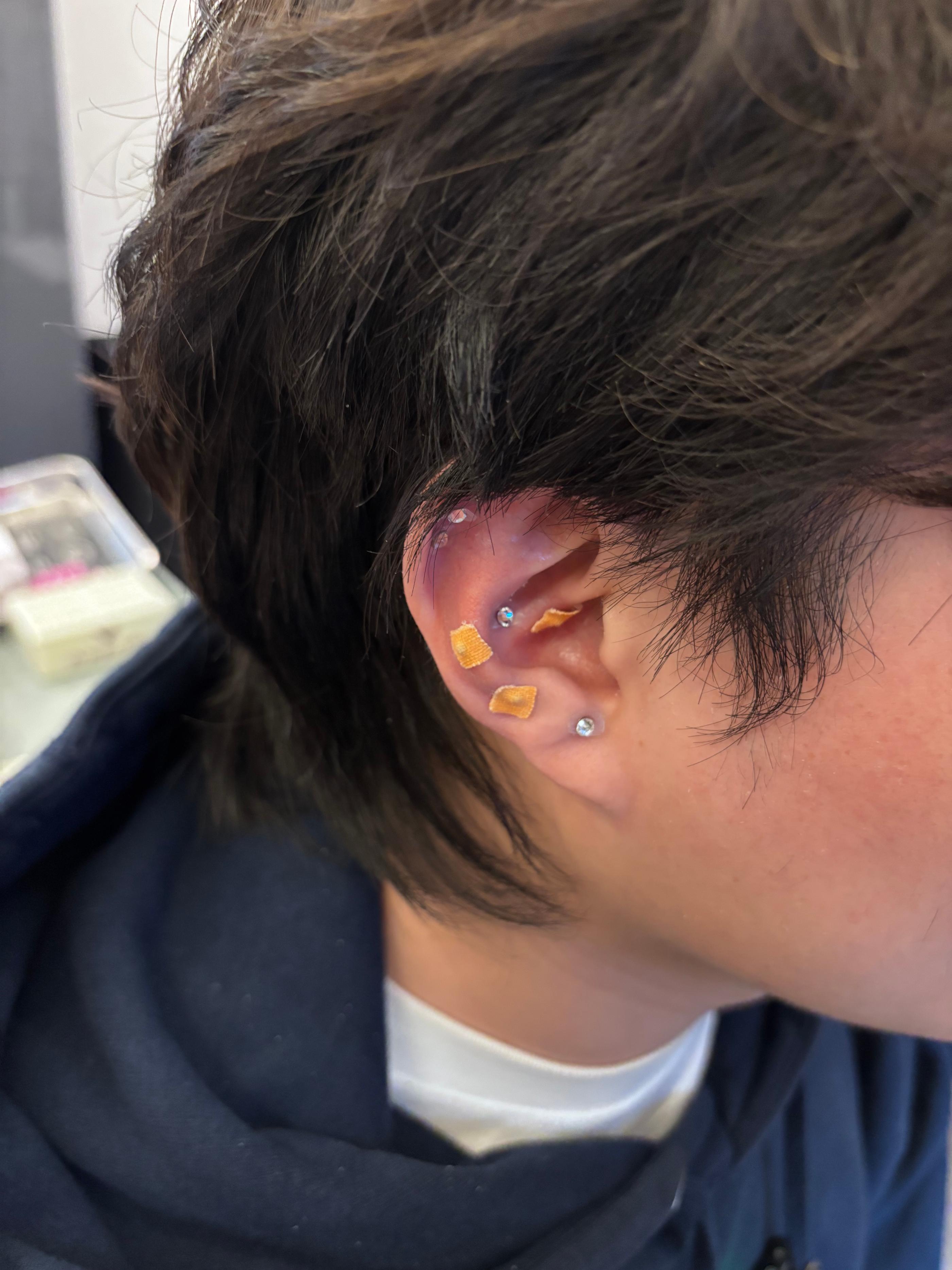 Weight Management I Myeongdong Siwon Korean Medicine Clinic 4